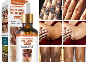 Dark Knuckle Whitening Serum In Dieren Town in the Netherlands, Elbow And Knee Brightening Serum In Butler Borough in New Jersey Call ☏ +2771 073 2372 Get Rid Of Tattoos In Polokwane City And Saldanha Town, Buy Dark Spots Products In Montagu Town In South Africa