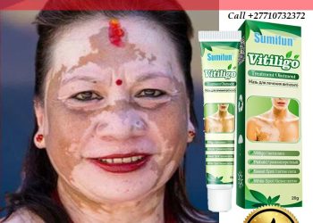 Get Rid Of Vitiligo In Hattem Municipality in the Netherlands And Vaasa City In Finland Call +27710732372 Scars And Stretch Marks In Vereeniging City In South Africa And Princeton Borough in New Jersey, United States